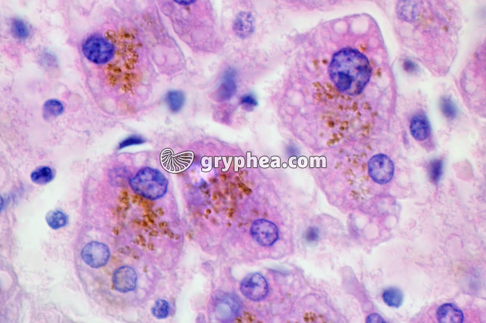 Foie humain x200 - gryphea.org